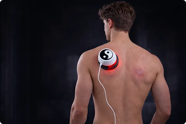 Cupping Therapy for Back Pain in Pakistan — Does It Really Work?