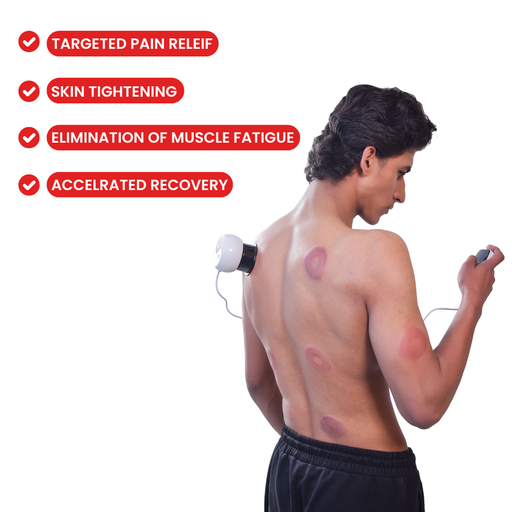  NUE Cupping Massager 