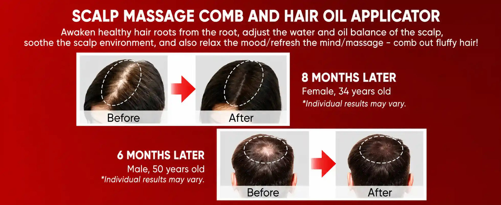 The Nue™ Scalp Therapy Brush - For Stronger -  Healthier Hair