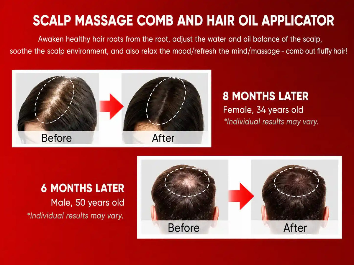 The Nue™ Scalp Therapy Brush - For Stronger -  Healthier Hair