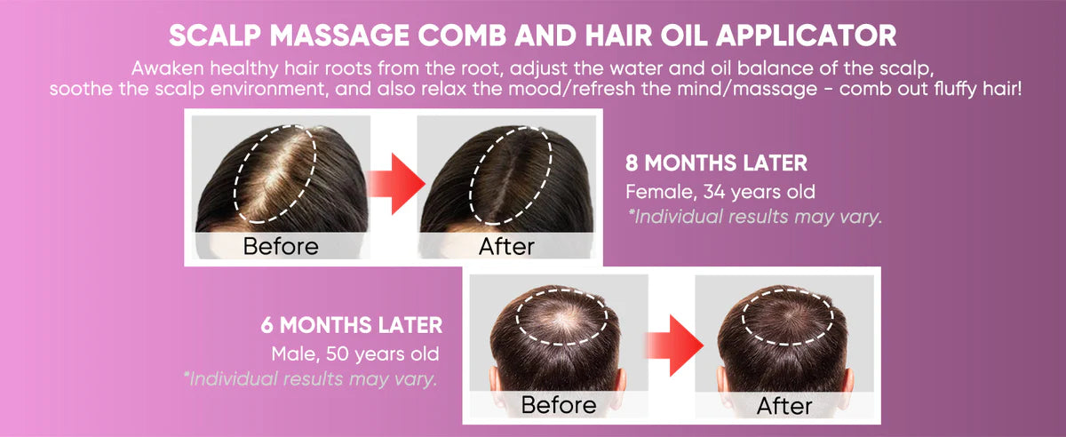 The Nue™ Hair Growth & Scalp Massager Brush