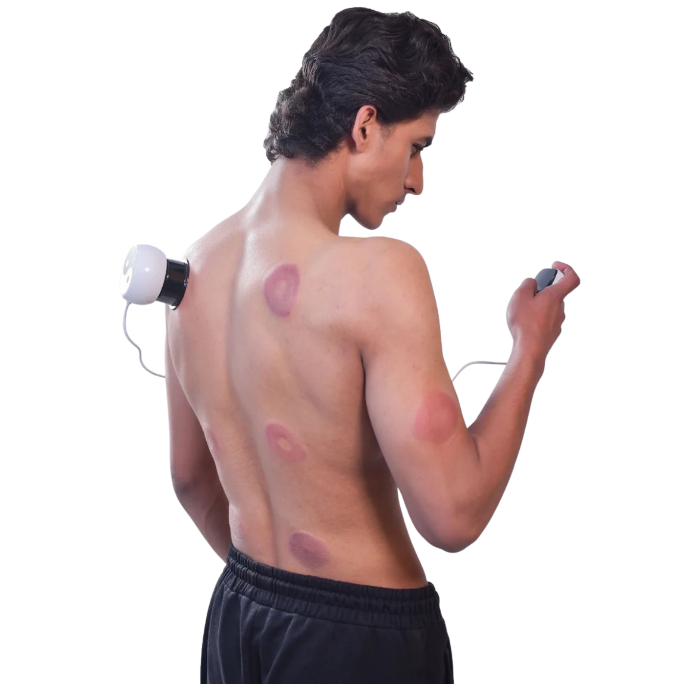 HOW CUPPING THERAPY WORKS